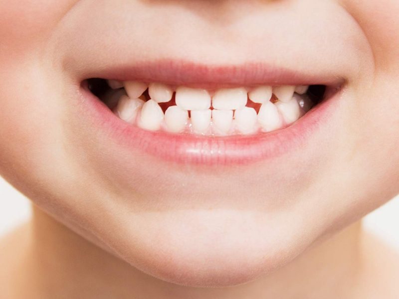 child-teeth-nightmares-e1590752406133