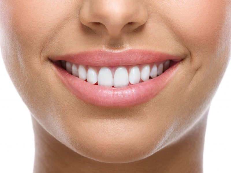 smile-anatomy-min